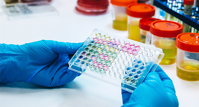 Сдайте анализы в вологодской лаборатории